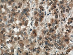 USP33 Rabbit anti-Human, Mouse, Rat, Polyclonal, Proteintech:Antibodies:Primary