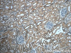 USP33 Rabbit anti-Human, Mouse, Rat, Polyclonal, Proteintech:Antibodies:Primary