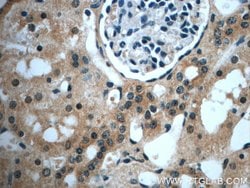 USP33 Rabbit anti-Human, Mouse, Rat, Polyclonal, Proteintech:Antibodies:Primary