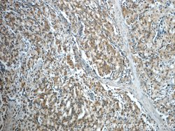 USP33 Rabbit anti-Human, Mouse, Rat, Polyclonal, Proteintech:Antibodies:Primary