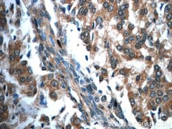 USP33 Rabbit anti-Human, Mouse, Rat, Polyclonal, Proteintech:Antibodies:Primary