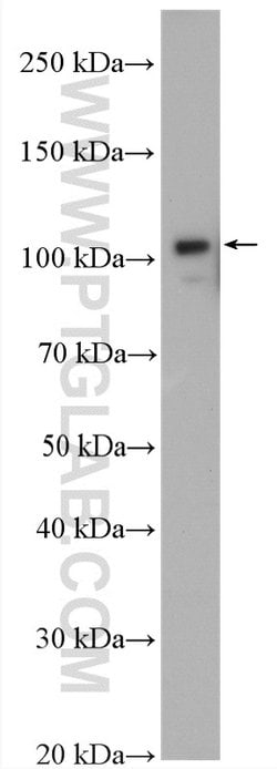 USP33 Rabbit anti-Human, Mouse, Rat, Polyclonal, Proteintech:Antibodies:Primary