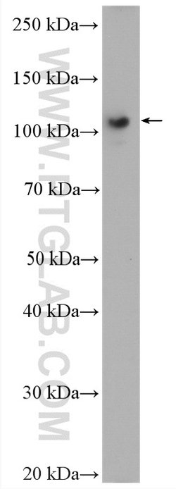 USP33 Rabbit anti-Human, Mouse, Rat, Polyclonal, Proteintech:Antibodies:Primary