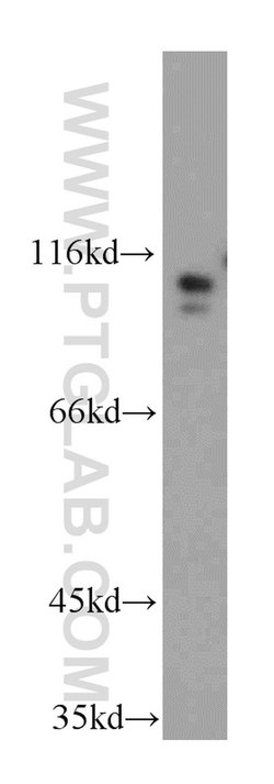 USP33 Rabbit anti-Human, Mouse, Rat, Polyclonal, Proteintech:Antibodies:Primary