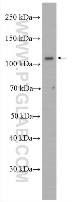 USP33 Rabbit anti-Human, Mouse, Rat, Polyclonal, Proteintech:Antibodies:Primary