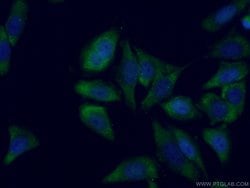SMN Rabbit anti-Human, Mouse, Polyclonal, Proteintech 150 &mu;L; Unconjugated:Antibodies,