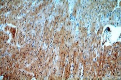 SMN Rabbit anti-Human, Mouse, Polyclonal, Proteintech 150 &mu;L; Unconjugated:Antibodies,