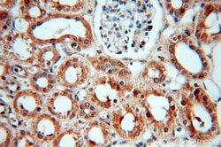 SMN Rabbit anti-Human, Mouse, Polyclonal, Proteintech 150 &mu;L; Unconjugated:Antibodies,