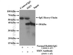 SMN Rabbit anti-Human, Mouse, Polyclonal, Proteintech 150 &mu;L; Unconjugated:Antibodies,