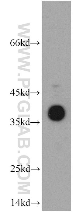 SMN Rabbit anti-Human, Mouse, Polyclonal, Proteintech 150 &mu;L; Unconjugated:Antibodies,