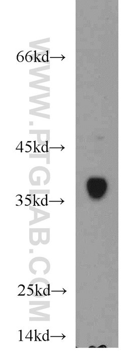 SMN Rabbit anti-Human, Mouse, Polyclonal, Proteintech 150 &mu;L; Unconjugated:Antibodies,