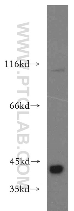 SMN Rabbit anti-Human, Mouse, Polyclonal, Proteintech 150 &mu;L; Unconjugated:Antibodies,