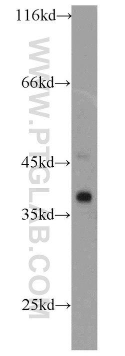 SMN Rabbit anti-Human, Mouse, Polyclonal, Proteintech 150 &mu;L; Unconjugated:Antibodies,