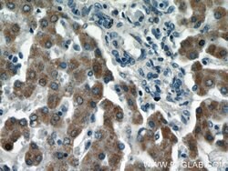 LRRC41 Rabbit anti-Human, Mouse, Rat, Polyclonal, Proteintech:Antibodies:Primary