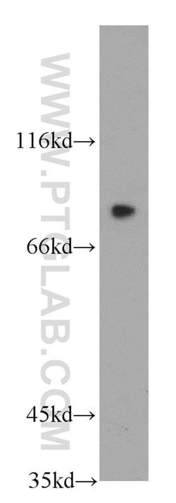 LRRC41 Rabbit anti-Human, Mouse, Rat, Polyclonal, Proteintech:Antibodies:Primary