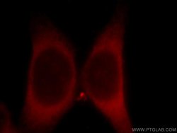 ZIP8 Rabbit anti-Human, Mouse, Polyclonal, Proteintech 150 &mu;L; Unconjugated:Antibodies,