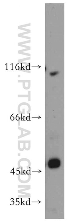 ZIP8 Rabbit anti-Human, Mouse, Polyclonal, Proteintech 150 &mu;L; Unconjugated:Antibodies,