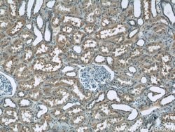 ZIP8 Rabbit anti-Human, Mouse, Polyclonal, Proteintech 150 &mu;L; Unconjugated:Antibodies,