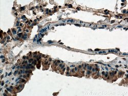 ZIP8 Rabbit anti-Human, Mouse, Polyclonal, Proteintech 150 &mu;L; Unconjugated:Antibodies,