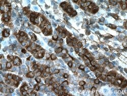 ZIP8 Rabbit anti-Human, Mouse, Polyclonal, Proteintech 150 &mu;L; Unconjugated:Antibodies,