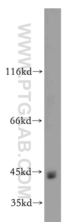 ZIP8 Rabbit anti-Human, Mouse, Polyclonal, Proteintech 150 &mu;L; Unconjugated:Antibodies,