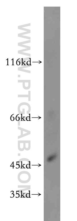 ZIP8 Rabbit anti-Human, Mouse, Polyclonal, Proteintech 150 &mu;L; Unconjugated:Antibodies,