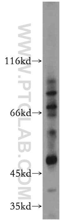ZIP8 Rabbit anti-Human, Mouse, Polyclonal, Proteintech 150 &mu;L; Unconjugated:Antibodies,