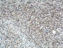 TMEM106A Rabbit anti-Human, Polyclonal, Proteintech 150 &mu;L | Buy Online | Proteintech Group Inc | Fisher Scientific
