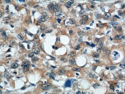 TMEM106A Rabbit anti-Human, Polyclonal, Proteintech 150 &mu;L | Buy Online | Proteintech Group Inc | Fisher Scientific