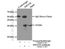 TSPAN2 Rabbit anti-Human, Mouse, Rat, Polyclonal, Proteintech 150 &mu;L;