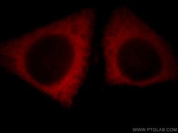 CCDC51 Rabbit anti-Human, Mouse, Rat, Polyclonal, Proteintech 150 &mu;L | Buy Online | Proteintech Group Inc | Fisher Scientific