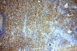 CCDC51 Rabbit anti-Human, Mouse, Rat, Polyclonal, Proteintech 150 &mu;L | Buy Online | Proteintech Group Inc | Fisher Scientific