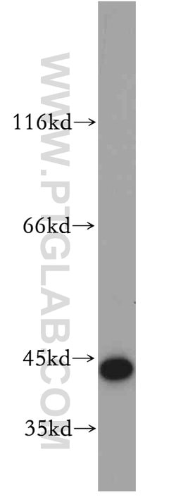 CCDC51 Rabbit anti-Human, Mouse, Rat, Polyclonal, Proteintech 150 &mu;L | Buy Online | Proteintech Group Inc | Fisher Scientific