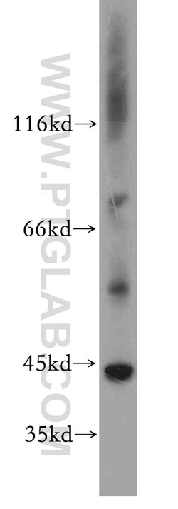 CCDC51 Rabbit anti-Human, Mouse, Rat, Polyclonal, Proteintech 150 &mu;L | Buy Online | Proteintech Group Inc | Fisher Scientific