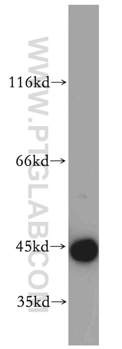 CCDC51 Rabbit anti-Human, Mouse, Rat, Polyclonal, Proteintech 150 &mu;L | Buy Online | Proteintech Group Inc | Fisher Scientific