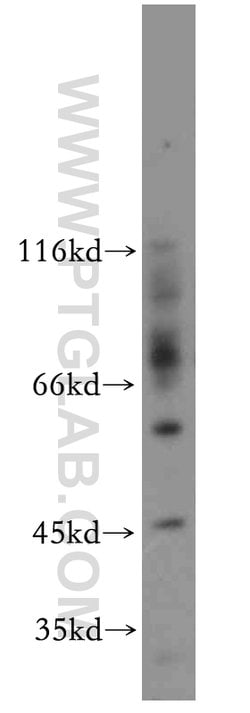 CCDC51 Rabbit anti-Human, Mouse, Rat, Polyclonal, Proteintech 150 &mu;L | Buy Online | Proteintech Group Inc | Fisher Scientific