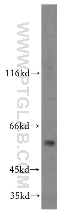 C9orf156 Rabbit anti-Human, Polyclonal, Proteintech 150 &mu;L; Unconjugated:Antibodies,
