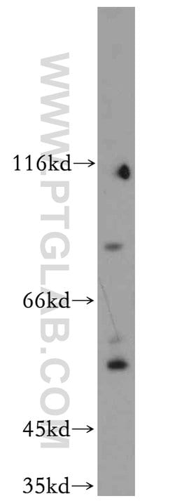 C9orf156 Rabbit anti-Human, Polyclonal, Proteintech 150 &mu;L; Unconjugated:Antibodies,