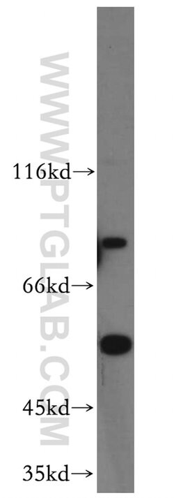 C9orf156 Rabbit anti-Human, Polyclonal, Proteintech 150 &mu;L; Unconjugated:Antibodies,