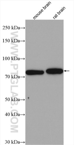 TBC1D17 Rabbit anti-Human, Mouse, Rat, Polyclonal, Proteintech 150 &mu;L | Buy Online | Proteintech Group Inc | Fisher Scientific