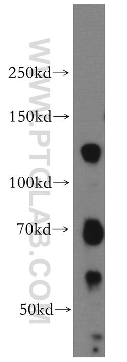 DAXX Rabbit anti-Human, Mouse, Polyclonal, Proteintech 150 &mu;L; Unconjugated:Antibodies,