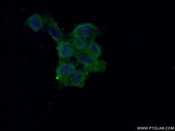 NME2 Rabbit anti-Human, Mouse, Rat, Polyclonal, Proteintech:Antibodies:Primary
