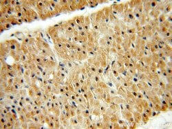 NME2 Rabbit anti-Human, Mouse, Rat, Polyclonal, Proteintech:Antibodies:Primary