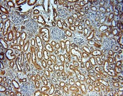 NME2 Rabbit anti-Human, Mouse, Rat, Polyclonal, Proteintech:Antibodies:Primary