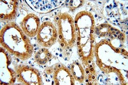 NME2 Rabbit anti-Human, Mouse, Rat, Polyclonal, Proteintech:Antibodies:Primary