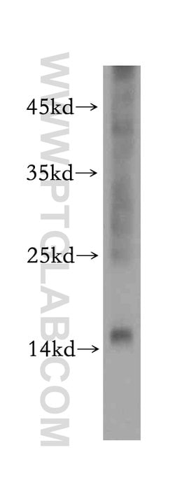 NME2 Rabbit anti-Human, Mouse, Rat, Polyclonal, Proteintech:Antibodies:Primary