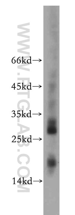 NME2 Rabbit anti-Human, Mouse, Rat, Polyclonal, Proteintech:Antibodies:Primary