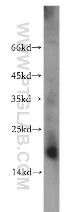 NME2 Rabbit anti-Human, Mouse, Rat, Polyclonal, Proteintech:Antibodies:Primary