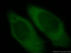 CEPT1 Rabbit anti-Human, Mouse, Rat, Polyclonal, Proteintech 150 &mu;L | Buy Online | Proteintech Group Inc | Fisher Scientific