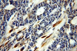 CEPT1 Rabbit anti-Human, Mouse, Rat, Polyclonal, Proteintech 150 &mu;L | Buy Online | Proteintech Group Inc | Fisher Scientific